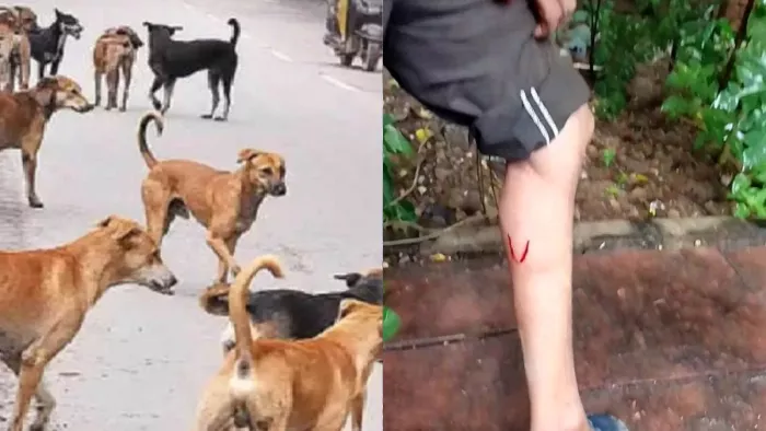 Ghaziabad Dog Attack: Failed to forget the bite of dogs, disappointment among people at the command of supremacy – NCR Ghaziabad Dog Bite Crisis Supreme Court decision disappointed residents of residents of residents