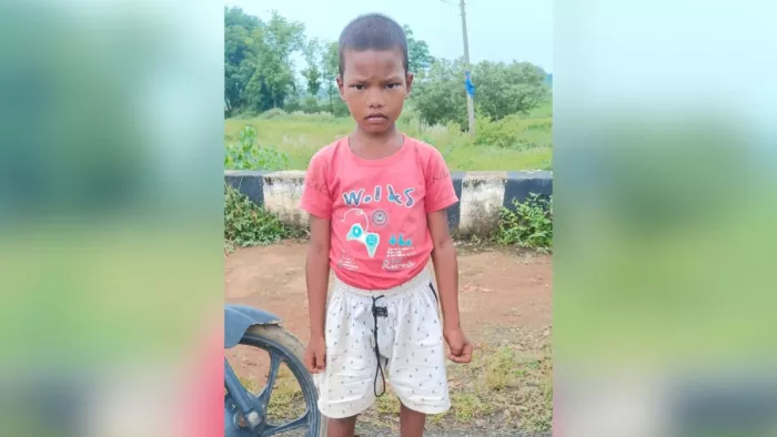 In Jharkhand, a private school teacher brutally struck the student, broke hands and feet; Cm noted the incident – teacher accused of being brutally beaten fir