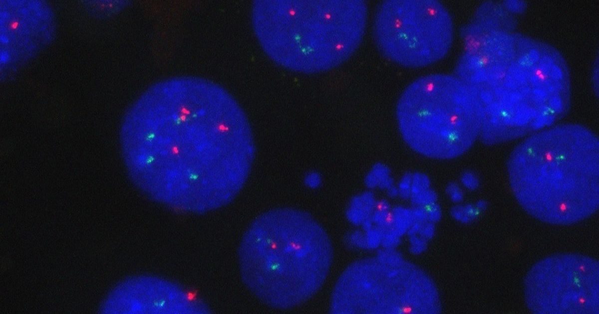 A surprise in cancer research paves the way for more effective treatment
