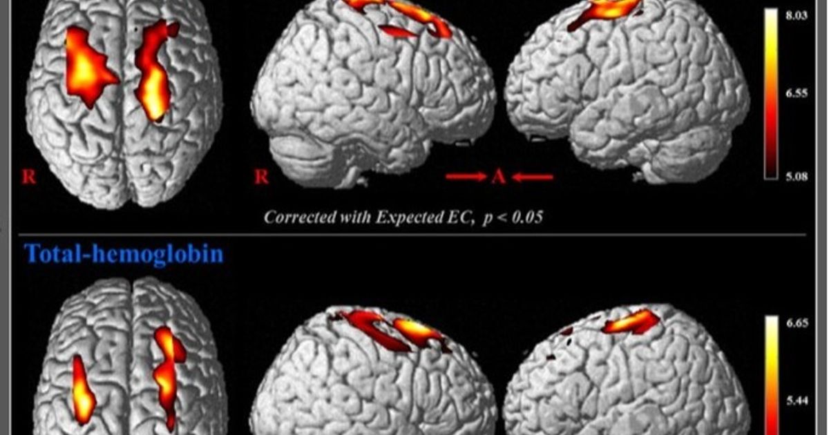 Medical discovery proclaims the treatment of aging diseases and neurological disorders