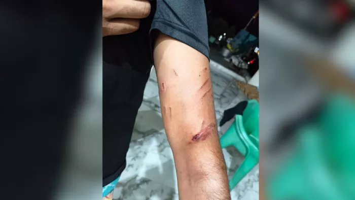 Labrador Dog was applied to the vaccine, suddenly hit the boss … owner -brother and hawk cut – Dog Attack Pet Dog Bites Three, including Kwak in Kasganj