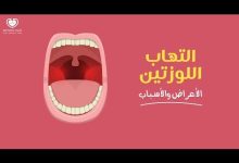 التهاب اللوزتين من الأمراض الشائعة التي تصيب الحلق. هل تعلم أسبابه وأعراضه؟..اكتشف طرق علاجه…