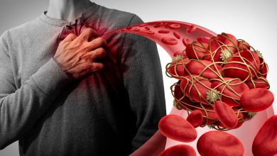 مشروبات تنظف شرايين القلب وتحميه من الجلطات