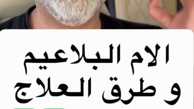 الام البلاعيم وطرق العلاج الطبيعية