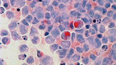 Is cancer really deadly?