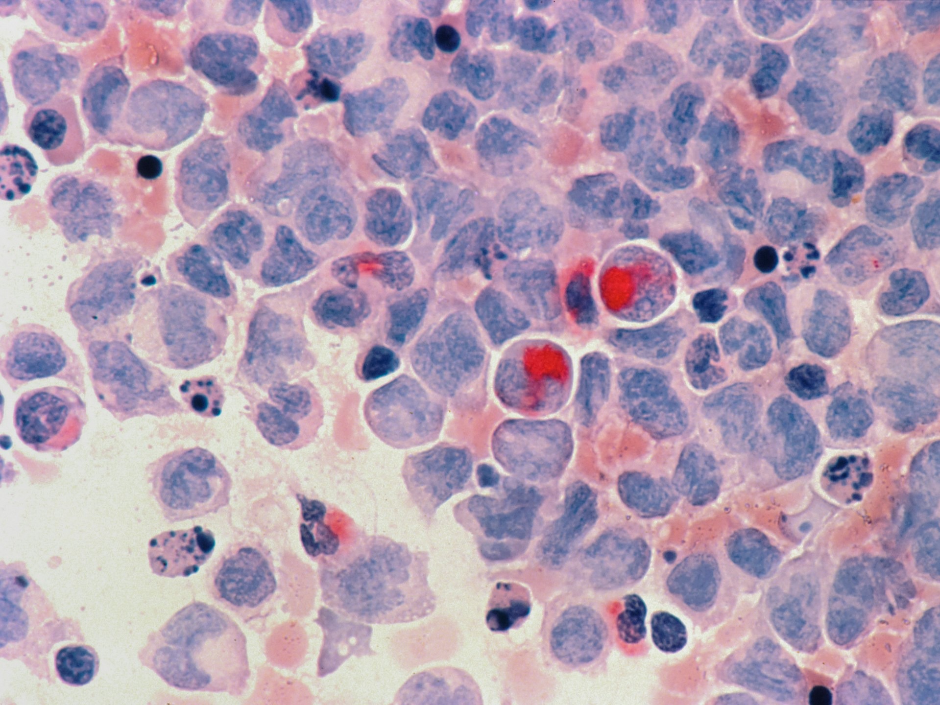 Is cancer really deadly?