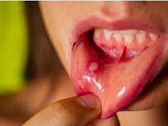 Houses that make up oral wires!