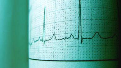 ‘Wake-up Call for Doctors …’: Neurologist responds to the death of Chennai Cardiac Surgeon after heart attack, list factors list