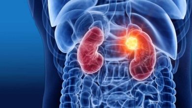 Researchers develop ‘ready’ immune treatment for any patient with kidney cancer