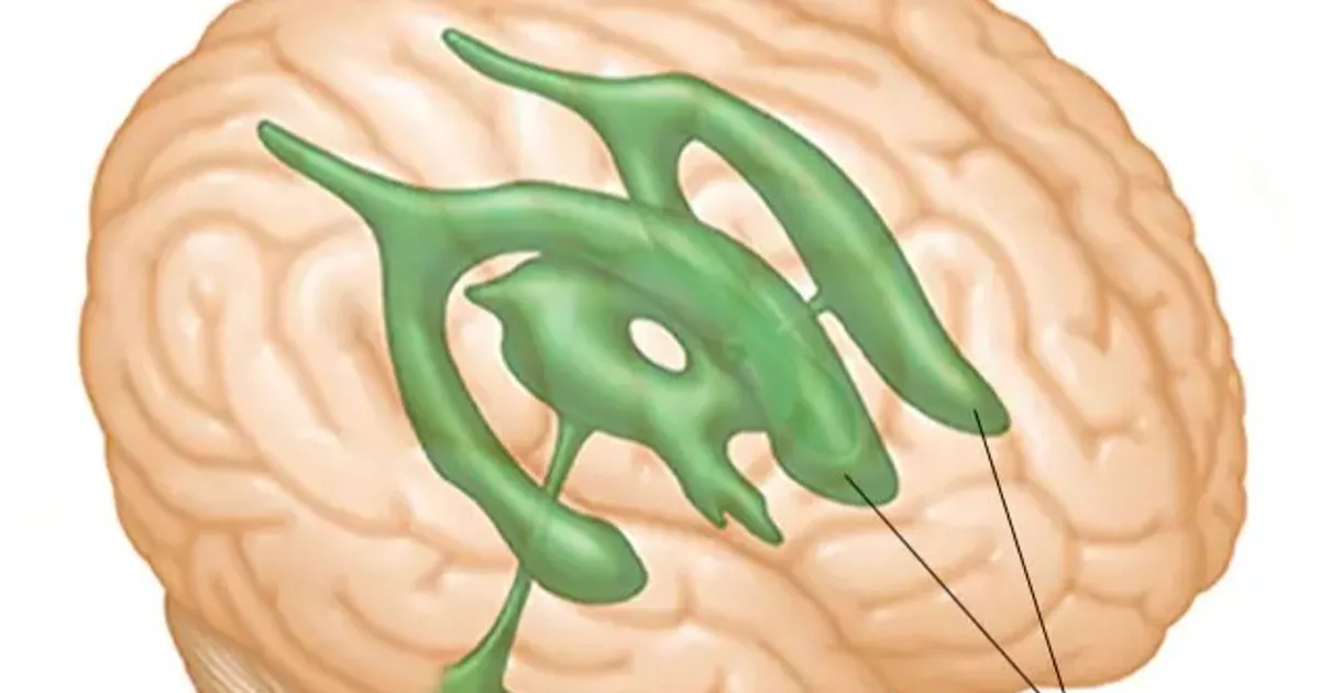 Celebale ascites … symptoms that require surgical intervention