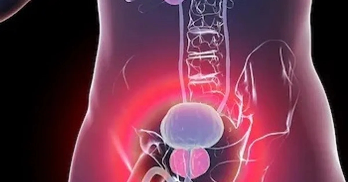 An innovative test to detect prostate cancer by urine samples