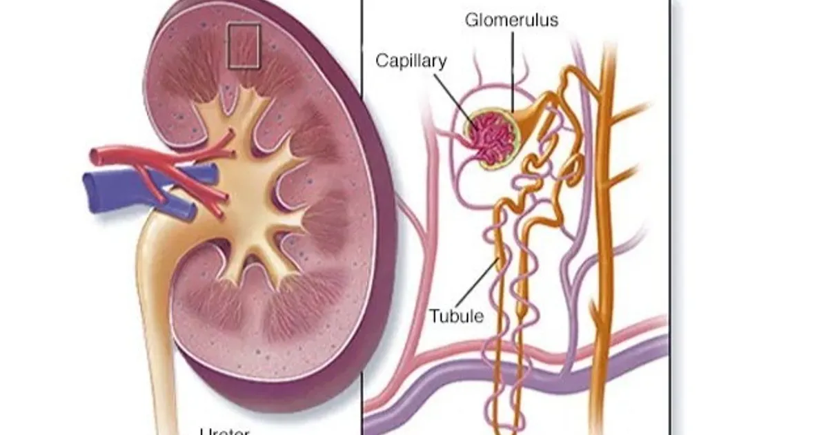 Causes of acute kidney infection and how to avoid it