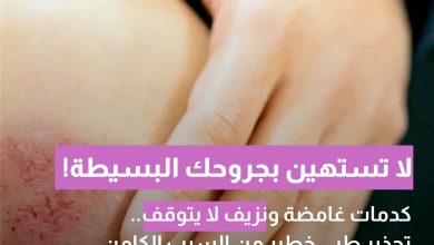 كدمات غامضة ونزيف لا يتوقف.. قد تكون علامة على اللوكيميا