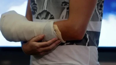 The braching curl .. an injury that can occur during childbirth