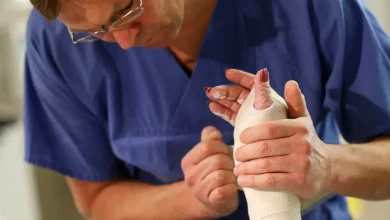 Hand fractures .. osteoporosis can be a cause