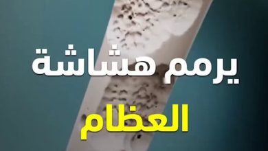 خليط صحي ومفيد جدا للجسم