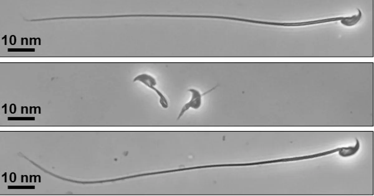 The discovery of sperm installation paves the way to diagnose the causes of infertility