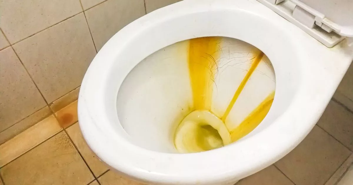 mrs-hinch-fans-swap-bleach-for-1.62-product-that-‘melts-off-toilet-limescale’