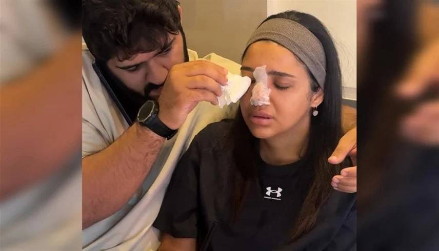 بلوغر مصرية كادت تفقد أنفها وبصرها بسبب «حقنة فيلر»