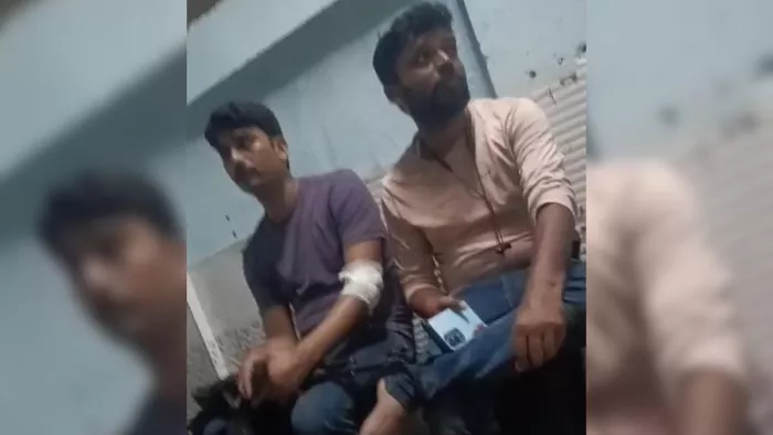 STF team attacked the accused in Vaishali, two policemen injured -STF team injured two police in Hajipur