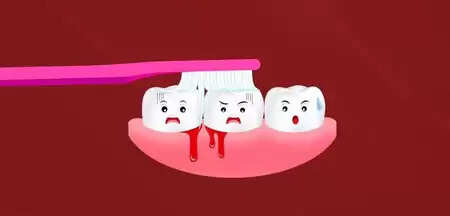 Bleeding of the gums is not just oral problem, it is also a gesture to internal problems of the body