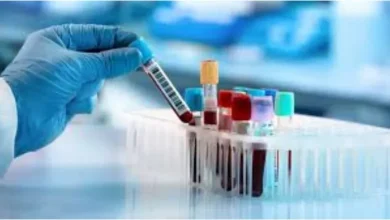 NEIDA: More than 17 Lakh people have done pathology check, 1 Lakh has not shown interest in taking reports -NCR -Free Pathology Tests Abuse on Hospitals