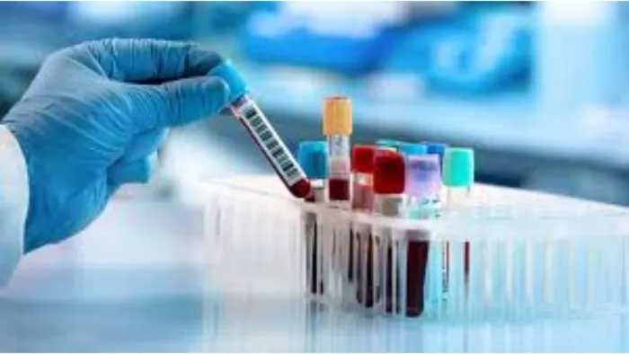 NEIDA: More than 17 Lakh people have done pathology check, 1 Lakh has not shown interest in taking reports -NCR -Free Pathology Tests Abuse on Hospitals