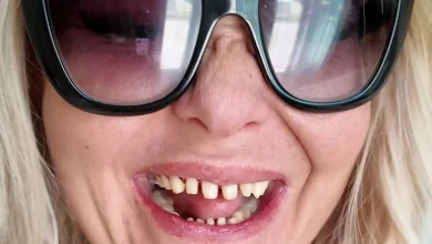 ‘I Started One Habit to Avoid Drinking Too Much and It Cost with My Teeth’ – ryan