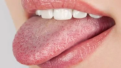 احذر.-علامات-على-اللسان-قد-تكشف-أمراض-خيرة