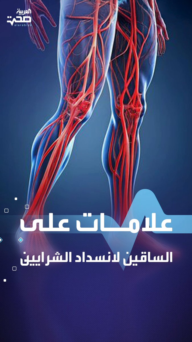 انتبه إليها.. علامات على ساقيك تشير إلى انسداد الشرايين _صحة #صحة