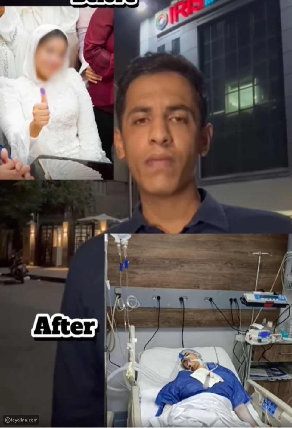 عروس مصرية تدخل في غيبوبة بسبسب إبرة تجميل – ryan