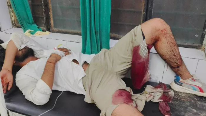 Three accused of arresting the Deputy Manager of Toll Plaza, two shot, two shot in the murder of a deputy manager of the Toll Plaza arrested in a meeting,