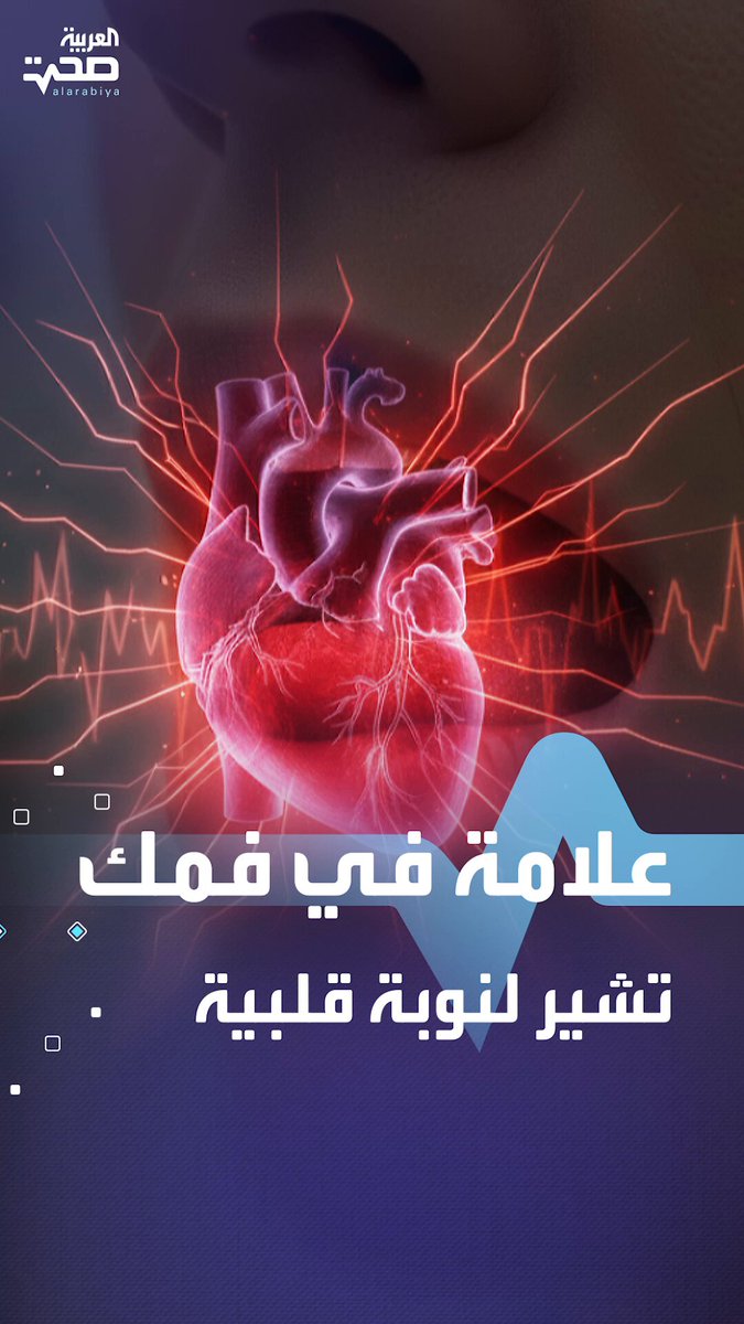 علامة في فمك قد تشير إلى نوبة قلبية وشيكة صحة _صحة