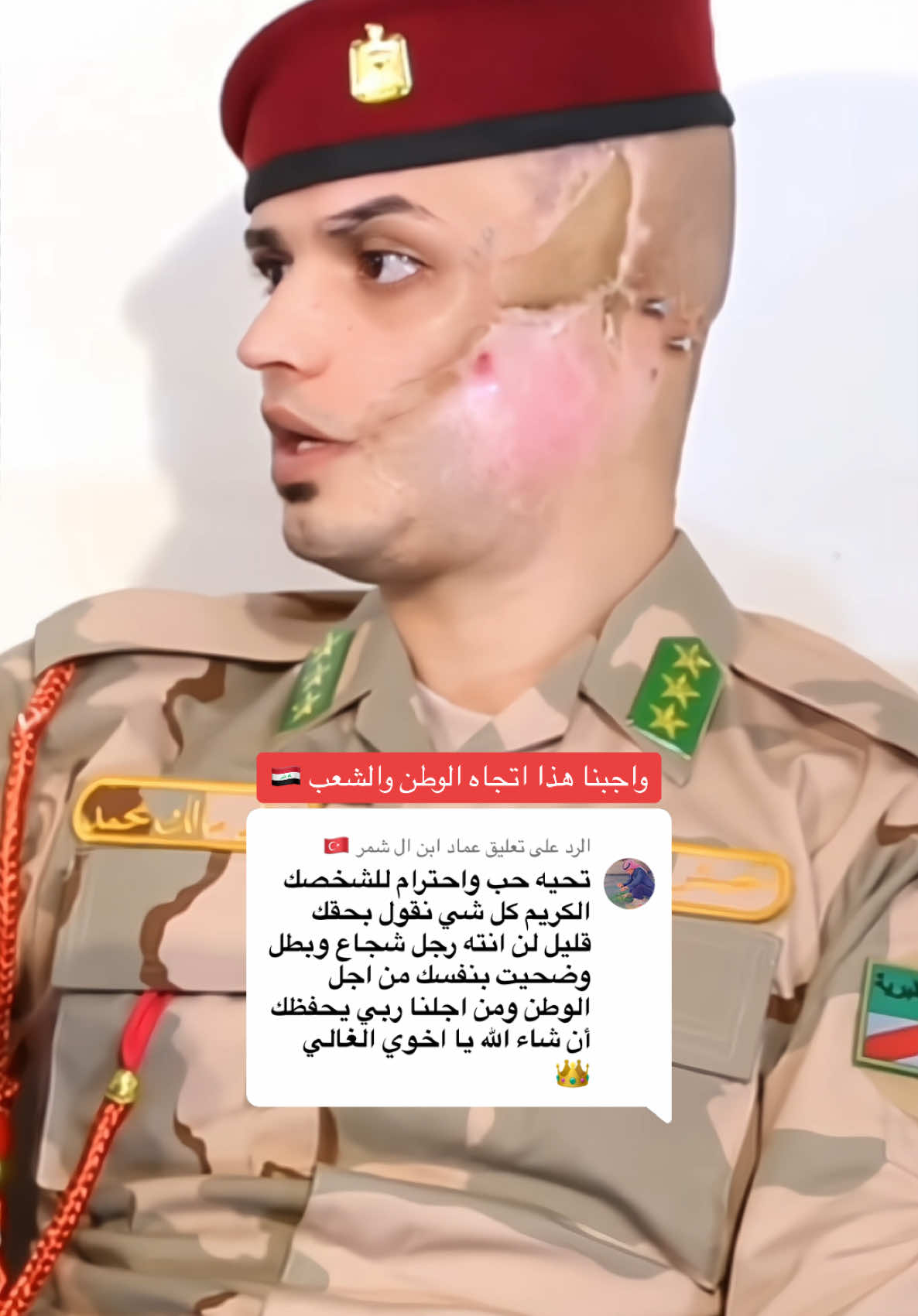 الرد على ابن ال شمر واجبنا هذا اتجاه الوطن والشعب #جريح_حرب_خالد_ائي #الج … – ryan