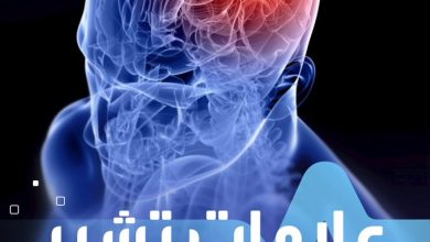 انتبه اليها.. 7 علامات قد تشير لوجود ورم في المخ صحة _صحة