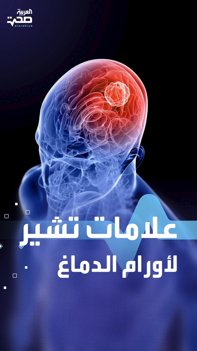 انتبه اليها.. 7 علامات قد تشير لوجود ورم في المخ صحة _صحة