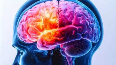 Vascular dementia is a major problem, brain damage by microplaste: study