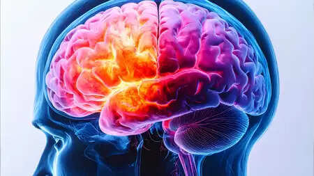 Vascular dementia is a major problem, brain damage by microplaste: study