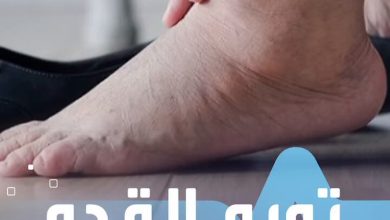 تورم القدم إنذار خطير