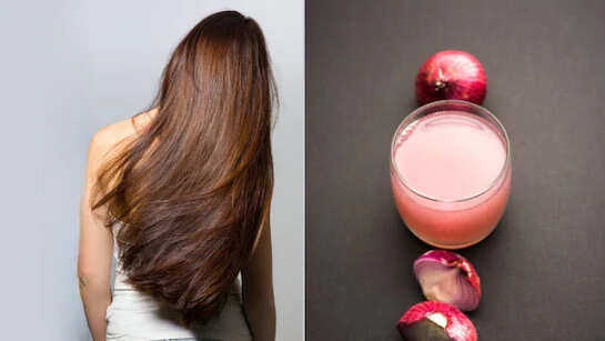 “Onion Hair Mask” is a blessing to hair, make these 4 ways and adjust hair masks, thick and long hairstyle