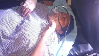 Boy threw sour on a nurse who went to the hospital, badly scorched, Delhi had to be referred to