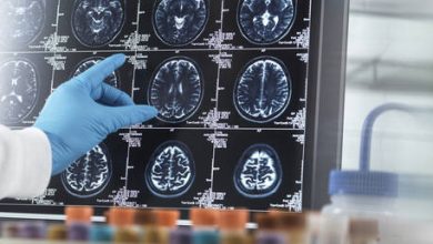 حركة غير متوقعة تحدث “صدمة” إيجابية للدماغ وتقوي الذاكرة