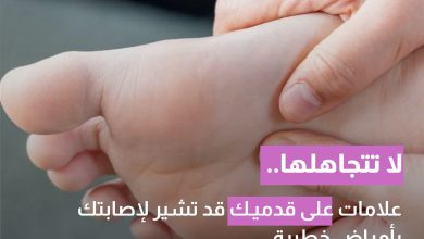 لا تتجاهلها.. علامات على قدميك قد تشير لإصابتك بأمراض خطيرة