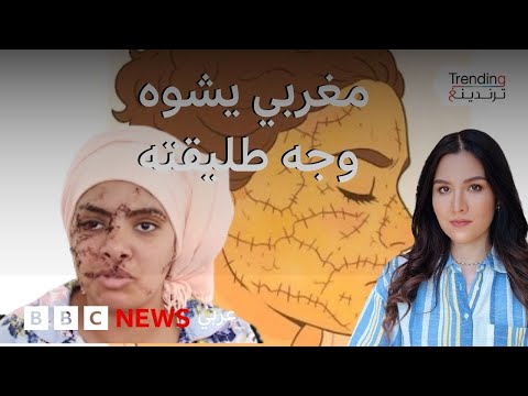 زوجوها له بعد اغتصابها.. رجل يشوه وجه طليقته بسلاح أبيض.. فما قصة إيمان المغربية؟