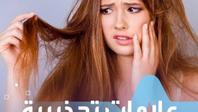 لا تتجاهليها.. علامات تحذيرية على شعرك قد تشير إلى حالات مرضية صحة _صحة