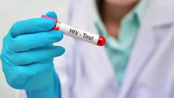 A stir among officers as a result of the acquisition of HIV infected prisoner in prison told the Supreme Court – what is the preparation for AIDS control in the laces – there were panic AMG officials after finding