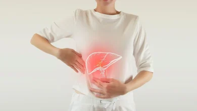 Delivers cerebral disorder … a deadly disease that can be avoided by following 8 tips