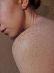 This is how your skin is decided!