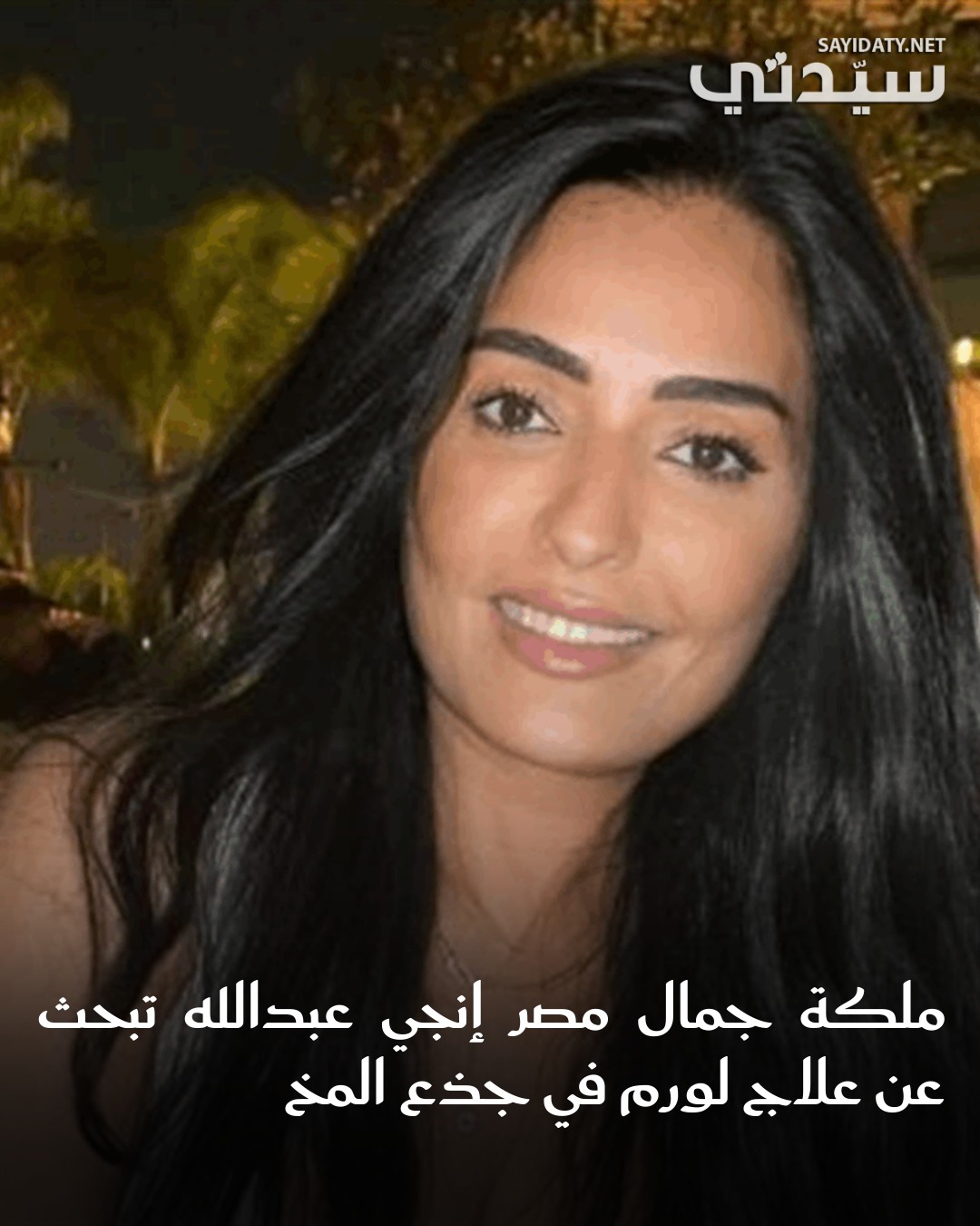 تزوُّج من سيدة أخرى.. ملكة جمال مصر السابقة تكشف عن صدمة تخلّي زوجها عنها أثناء رحلتها الصعبة…