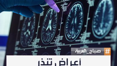 اختصاصي جراحة المخ والأعصاب محمد ملحم يحذر من علامات مبكرة قد تُنذر بالإصابة بالسكتة الدماغية…